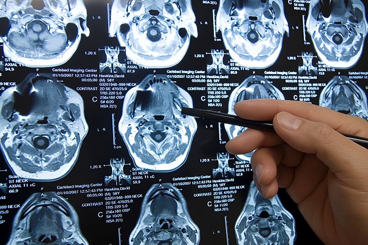 核磁共振机器有多耗电,核磁共振设备需要多少钱一台