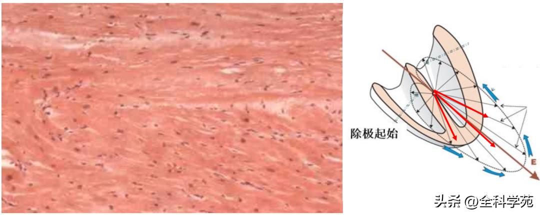 心电图qrs时限超宽是什么引起的,心电图qrs波呈m型见于什么疾病