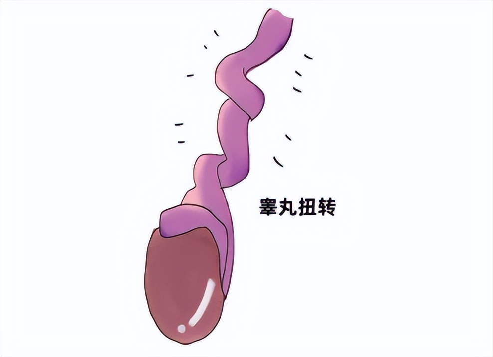 男人两个卵子切除后会死吗,男子两个睾丸都切除了还会遗精吗