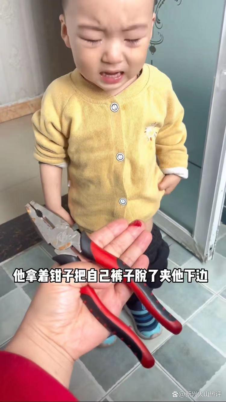 男童玩钳子不慎被夹伤上厕所,孩子满身被钳子夹伤