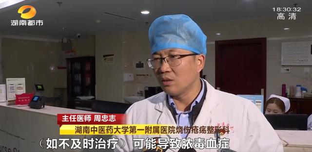 鸭子被狗抓伤怎么办,鸭子和小鸡抓伤要不要打疫苗