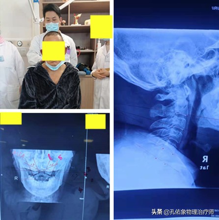 肩膀肌肉紧绷怎么放松,肩膀僵硬不放松怎么办