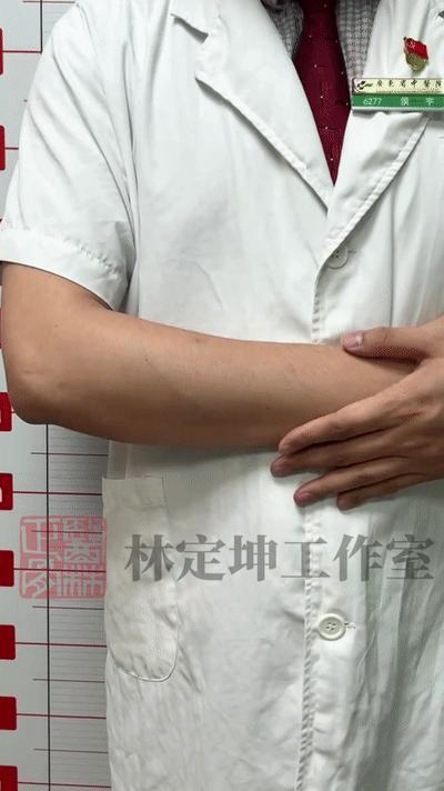 手肘筋劳损最快恢复方法,肘关节错位中医正骨