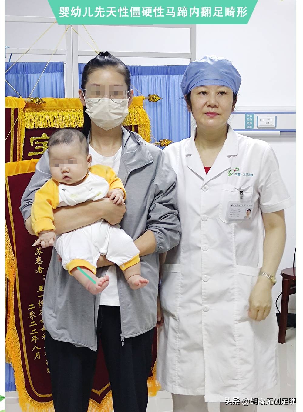 儿童足内翻最快的恢复方法,小儿足内翻怎么判断