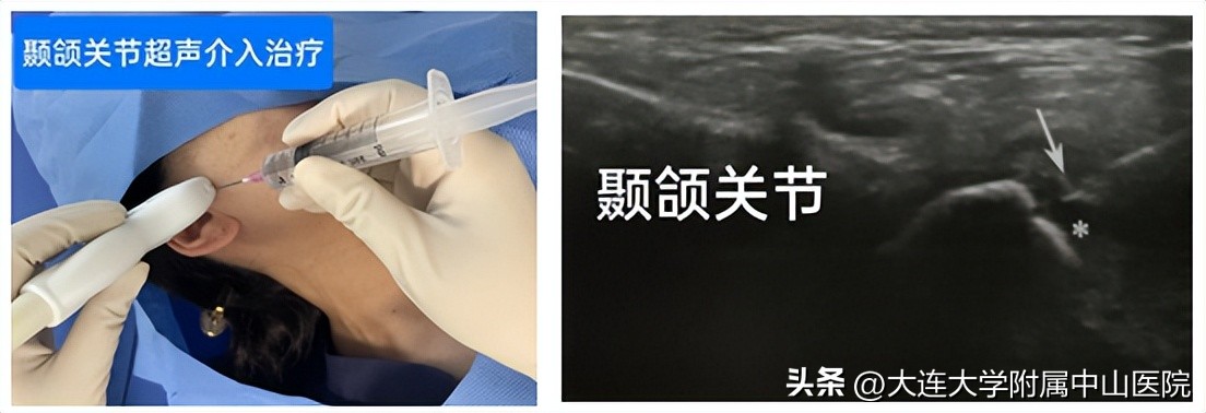 西安肌骨超声精准治疗,门诊超声