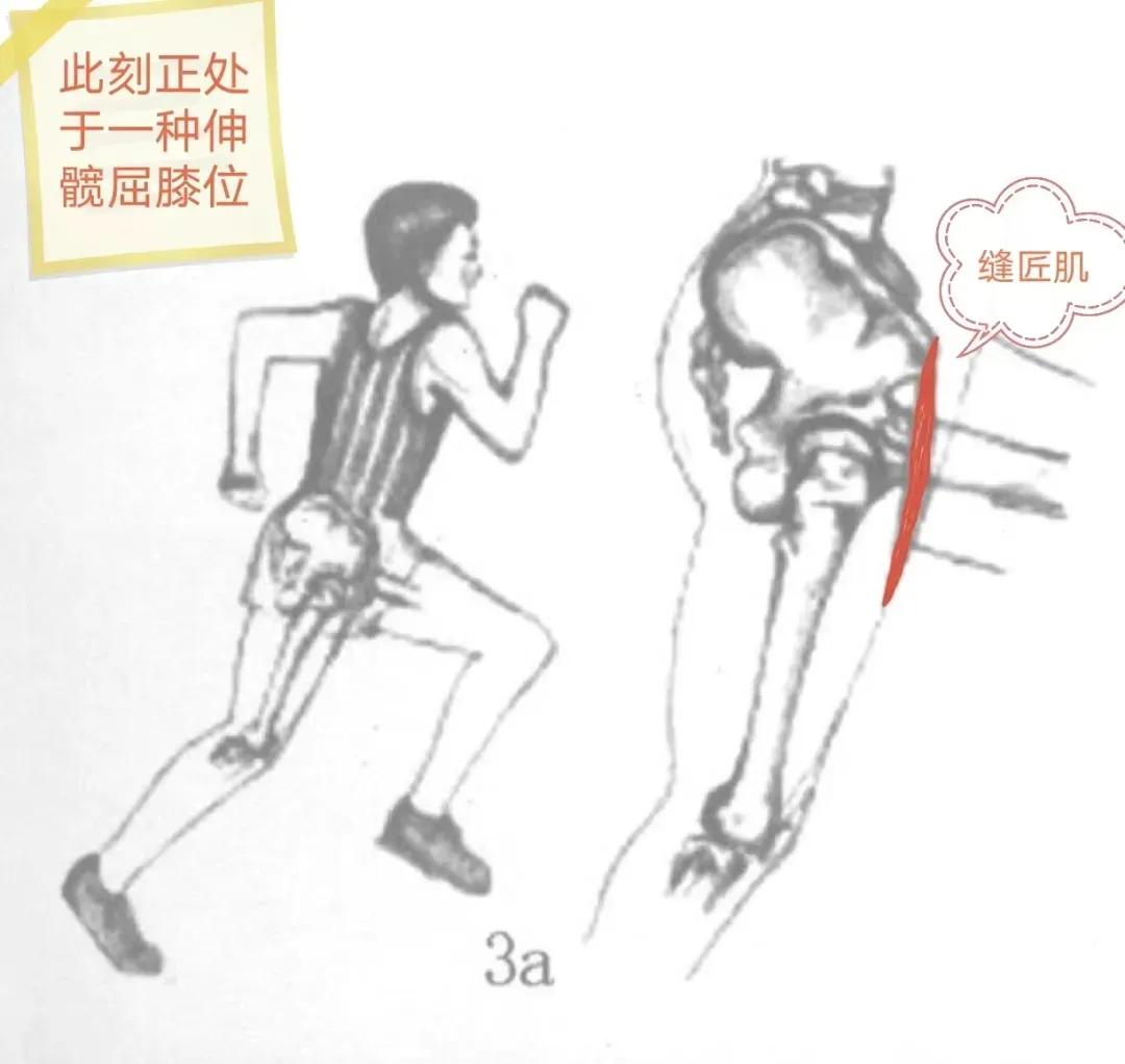 警惕｜跑完步后大腿根痛，一查竟是骨折了，青少年多见