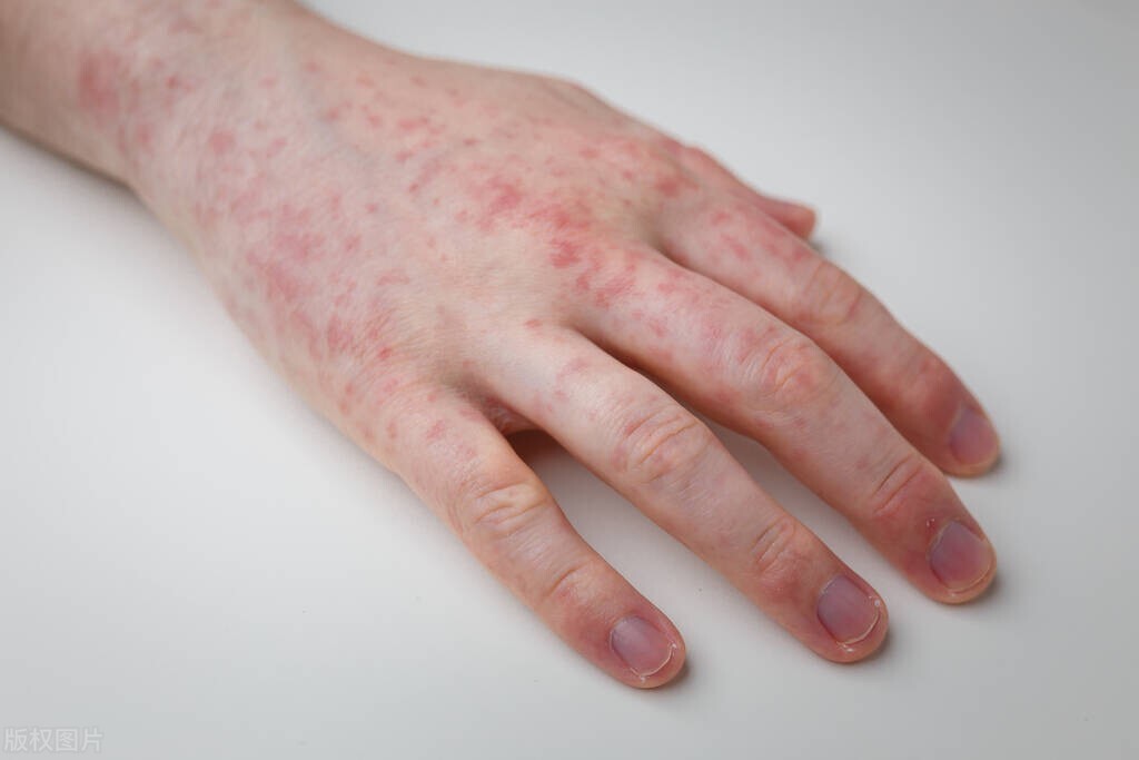 安全套就一定能不被传染吗,安全套就一定卫生吗