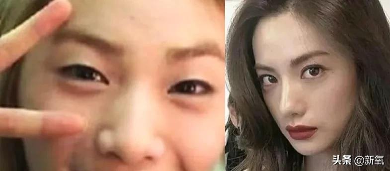 如何知道自己的脸往哪一边歪,怎么知道自己的脸是不是歪的