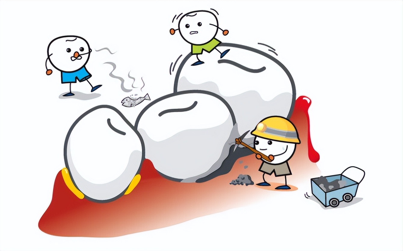 牙结石可以自己抠掉吗教你几招,牙结石自己可以抠掉吗教你小窍门