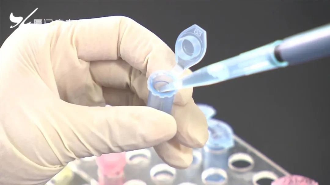 厦门哪里有卖抗原检测试剂盒,厦门有哪些抗原试剂厂