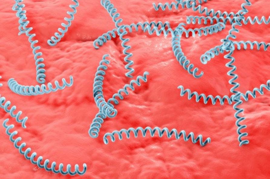 得了梅毒有什么症状？身上会痒吗？梅毒可以治愈吗？建议了解一下