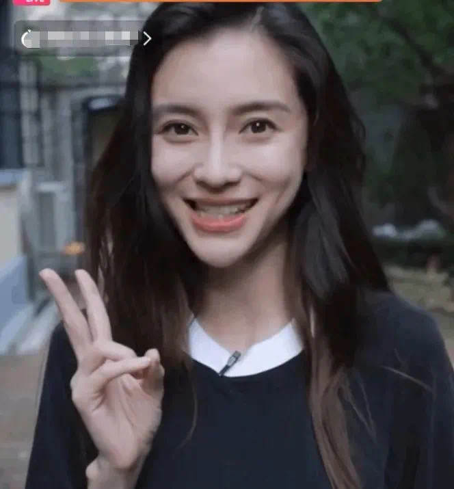 哪些明星整容后遗症越来越严重,整容明星后遗症对比图片