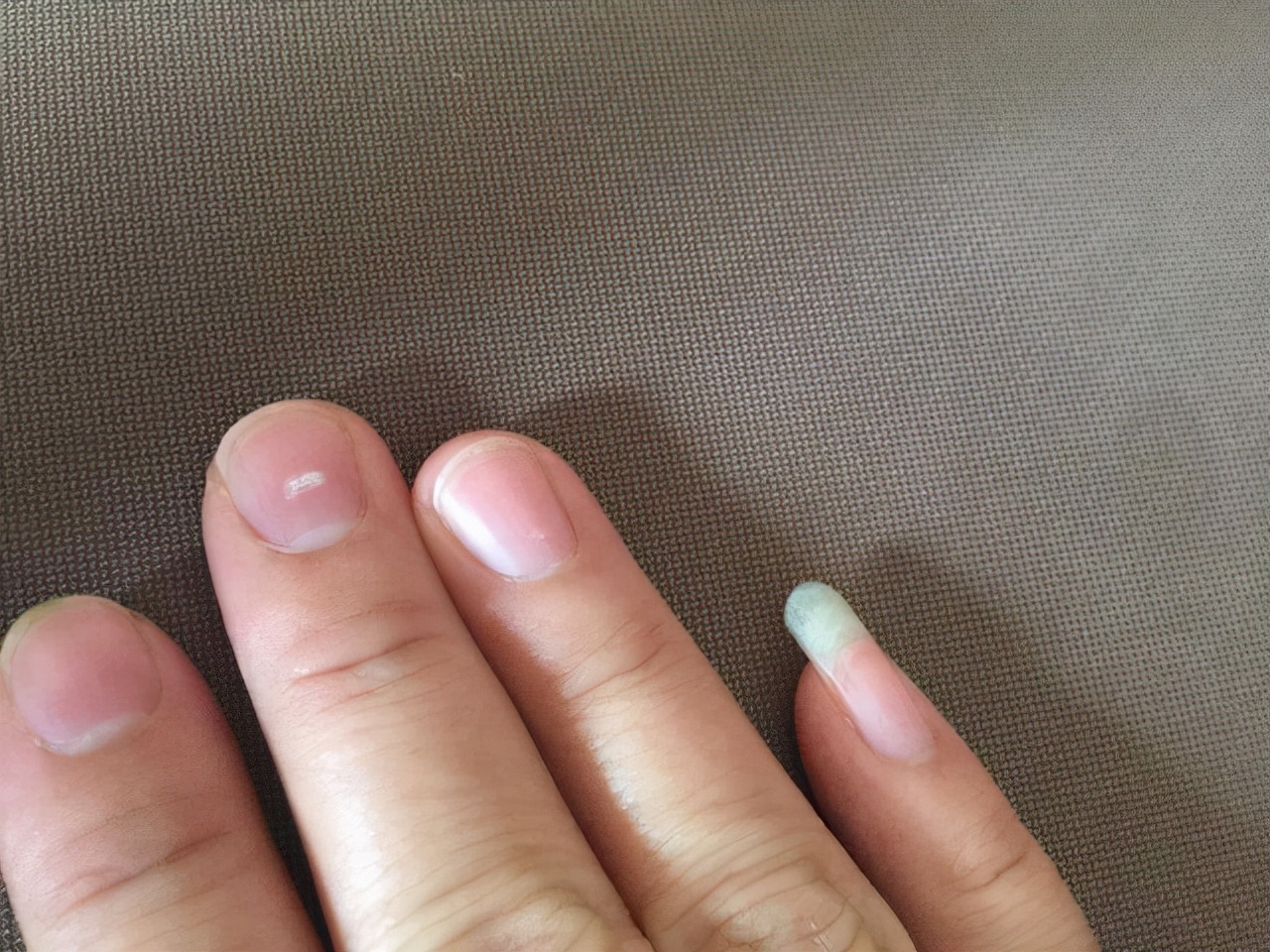 十岁孩子指甲上有竖纹是怎么回事,手指甲出现竖纹是身体哪里的原因