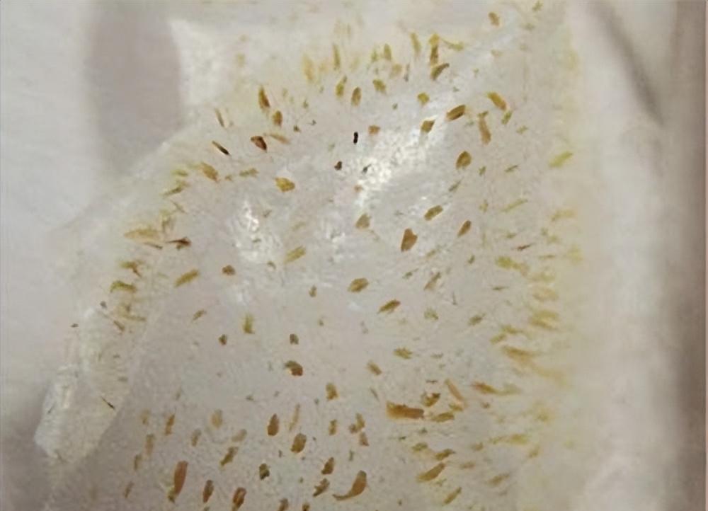 鼻子黑头里挤出的白色油脂怎么办,鼻子上有硬硬的黑头怎么办