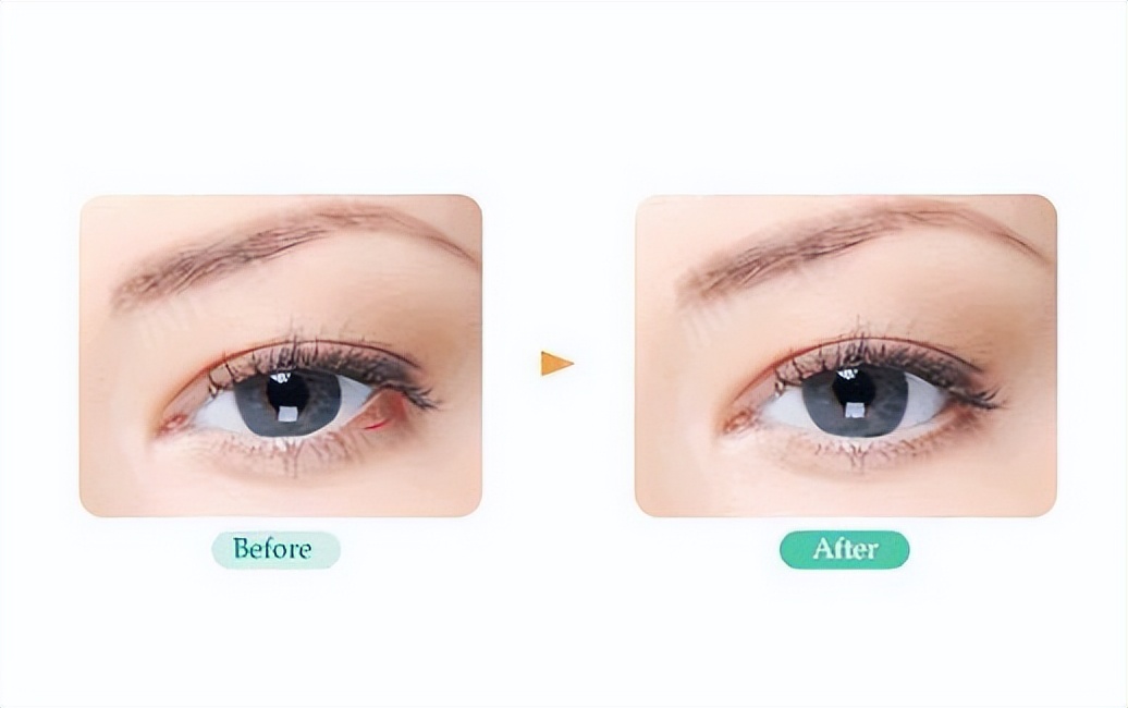 眼角下垂割双眼皮眼尾拉长,眼角上扬眼尾下垂怎么画眼线