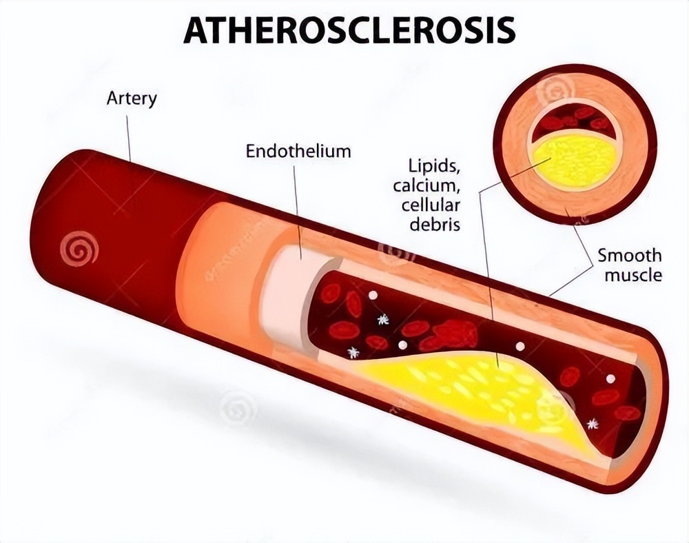 大豆异黄酮是处方药吗,大豆异黄酮是药还是补品