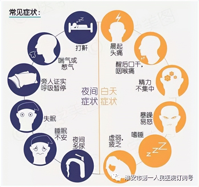 淮安治疗打呼噜哪个医院好,打呼噜睡眠不好的人看过来