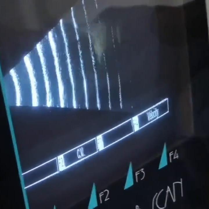 眼底超声检查视网膜裂孔,眼科b超能看出视网膜脱落吗