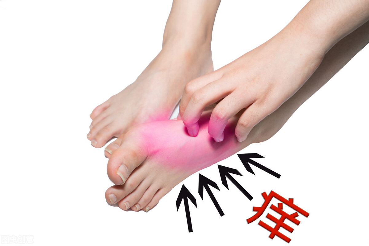 足癣有什么药泡脚,足癣煎中药泡脚步骤