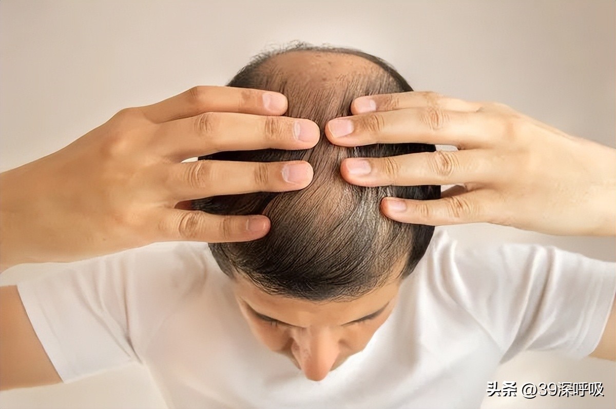 那些秃了顶的中年男人，还在挣扎着笑对人生