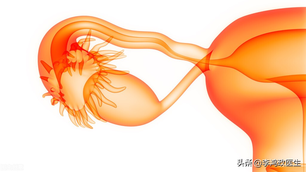腰间盘突出有没有可能误诊,女子腰痛误诊腰椎间盘突出