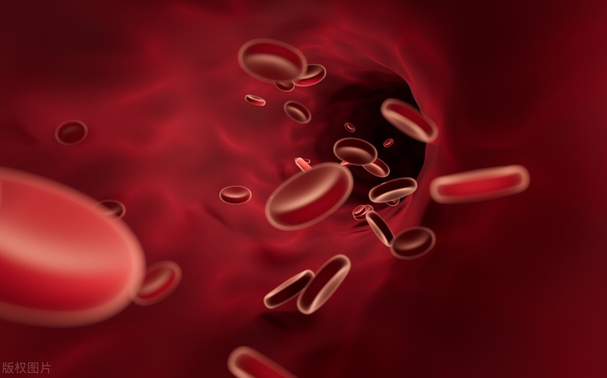 血管斑块能不能自己消除,血管病能治好吗