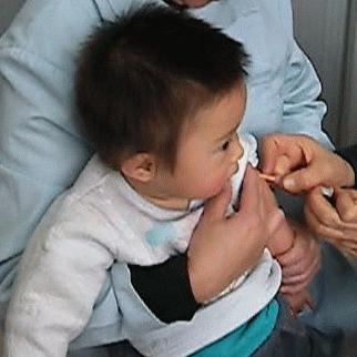 儿童腺样体增生伴有鼻炎,孩子鼻炎腺样体增生扁桃体肥大