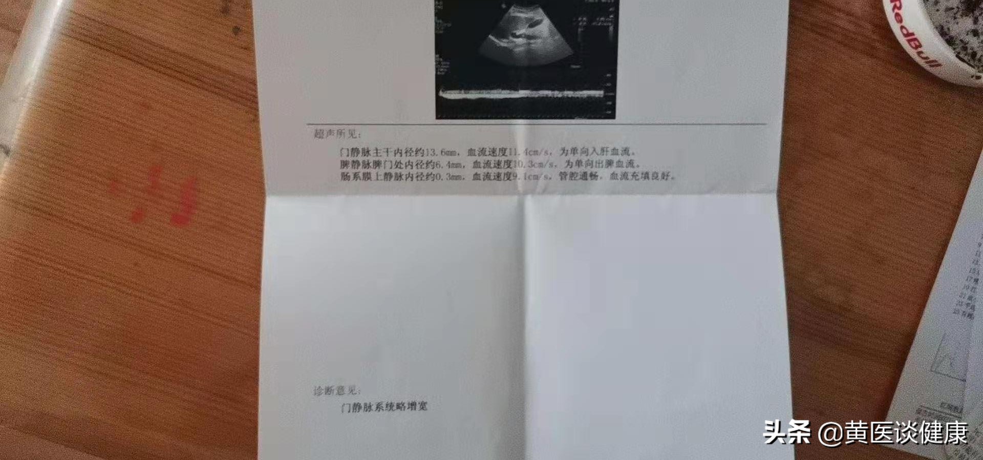 单用干扰素治疗乙肝，表面抗原降至个位数，但无法转阴，怎么办？