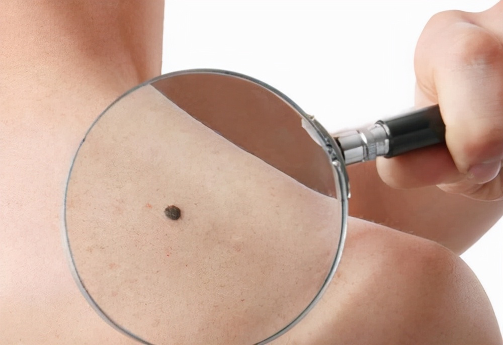 皮肤出现小红点像血点是怎么回事,皮肤上出现了小红点是什么症状