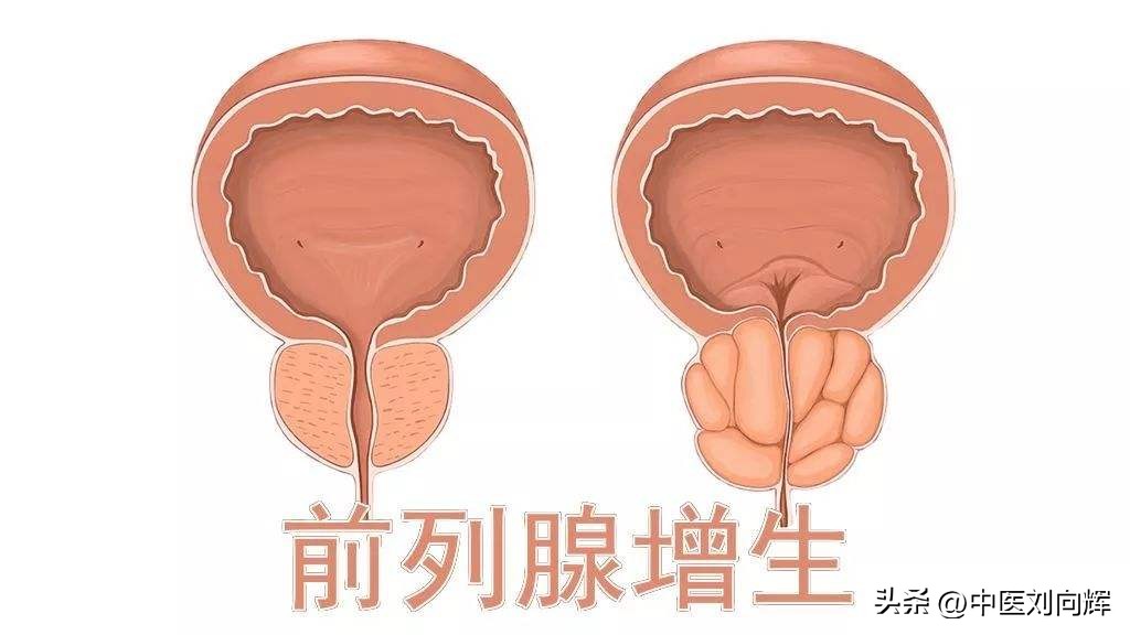 金匮肾气丸有利尿的作用吗,金匮肾气丸能治疗什么病