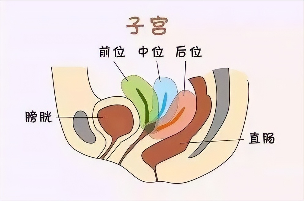子宫后位会造成痛经吗,子宫后位趴着睡能矫正吗