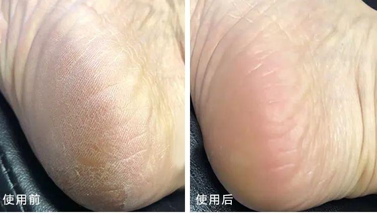 在国外比较好的国货护肤品,在国外畅销的国货