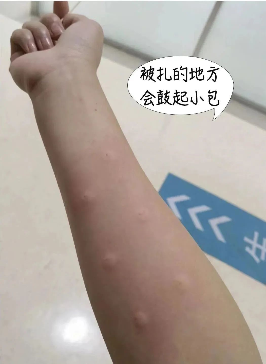 第一批阳性的孕妇生产,首阳孕妇咳嗽