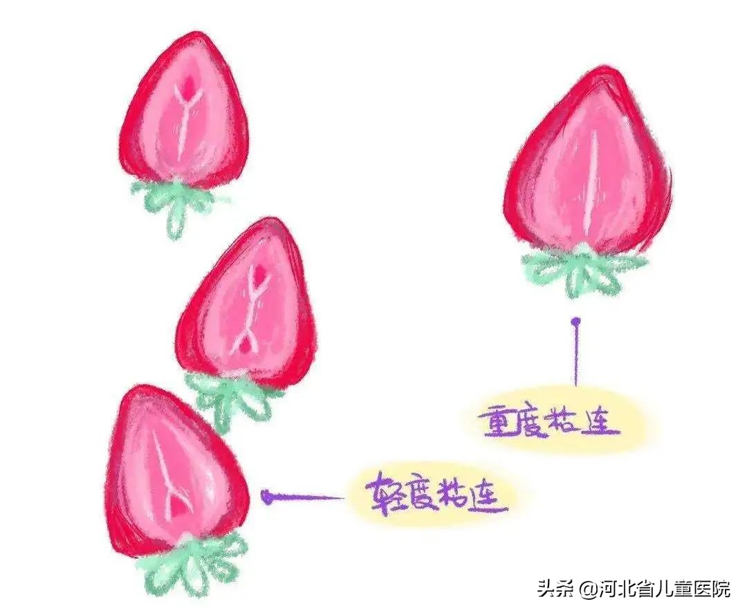 男宝宝尿道口不明显,宝宝尿尿被吓醒