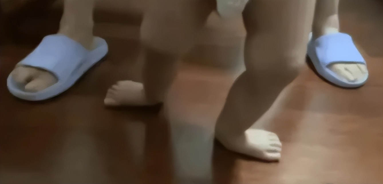 1岁宝宝不愿走路总是要爬怎么办,2岁宝宝一只脚扁平足怎么办