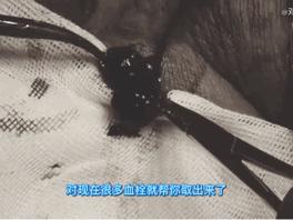 腿上起红肿大包疼,快告诉爸妈碰到这些人要当心