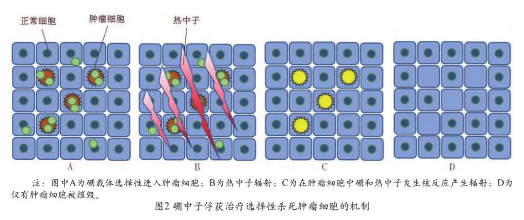 30分钟杀灭癌细胞,怎么能彻底杀死癌细胞