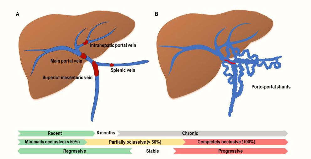 肝硬化门静脉高压伴血栓处理办法,介入后出现下腔静脉血栓