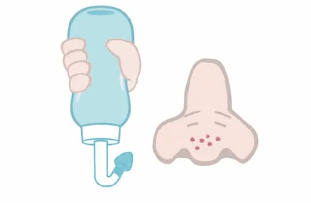 鼻炎鼻子堵塞不通气怎么办,鼻子不通气鼻塞流鼻涕快速通气药