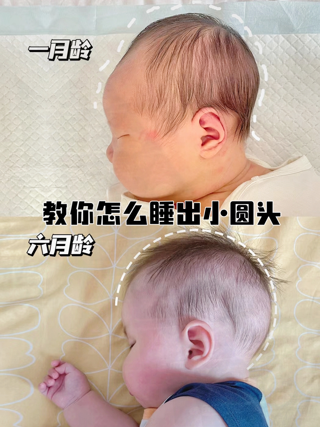 怎么教宝宝变头位,宝宝头型教程新手