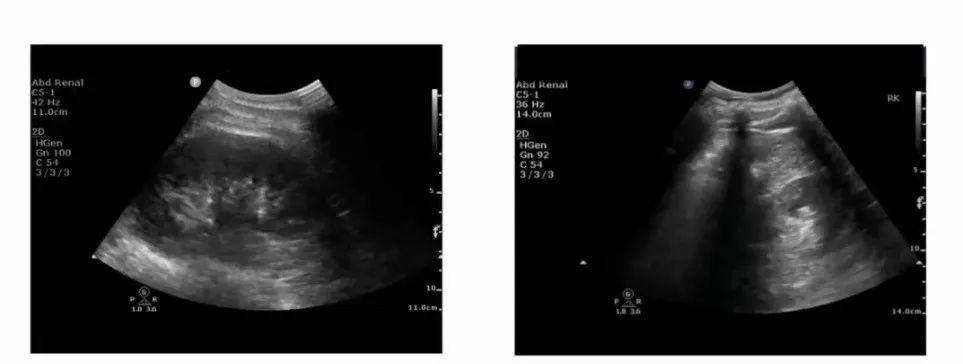 「肾脏病学」刘丽霞教授：肾脏血流动力学监测实施路径