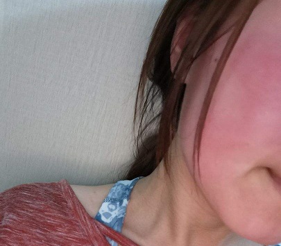 脸上很油是好还是坏,脸上感觉油但是起皮