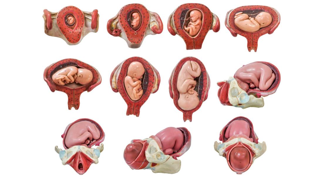 胎位不正想顺产平时应该怎么做,胎位不正医生用手纠正