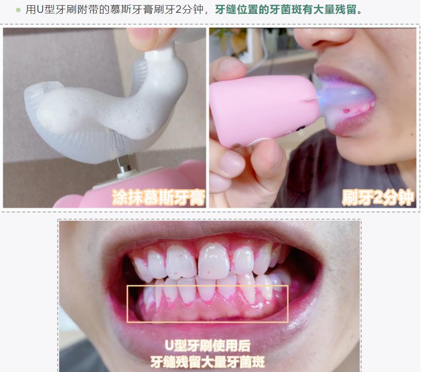 儿童如何预防蛀牙？谨防16个危害误区