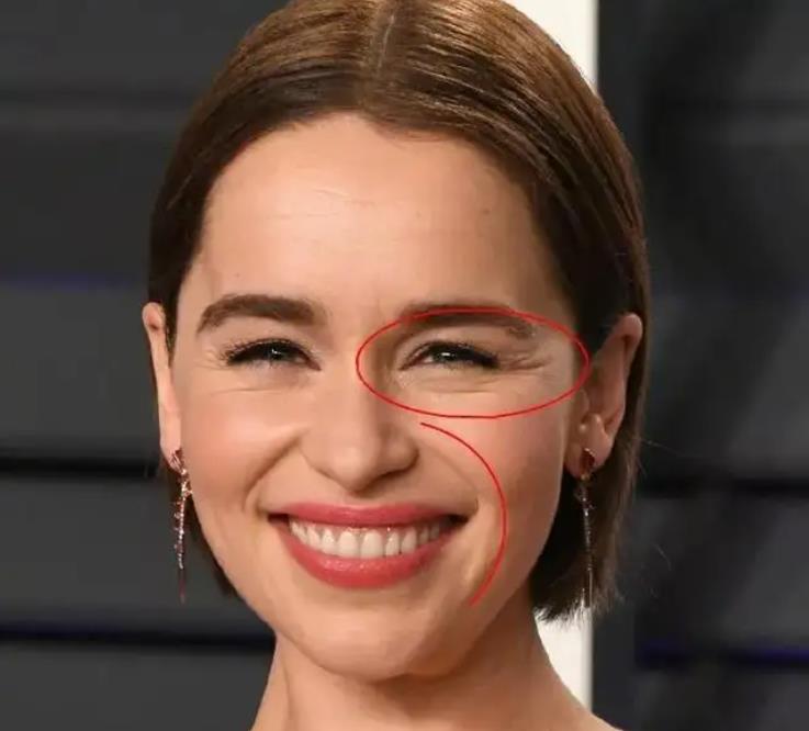 一笑就出法令纹和眼角纹？这两大成分专攻“表情纹”，就是太费钱