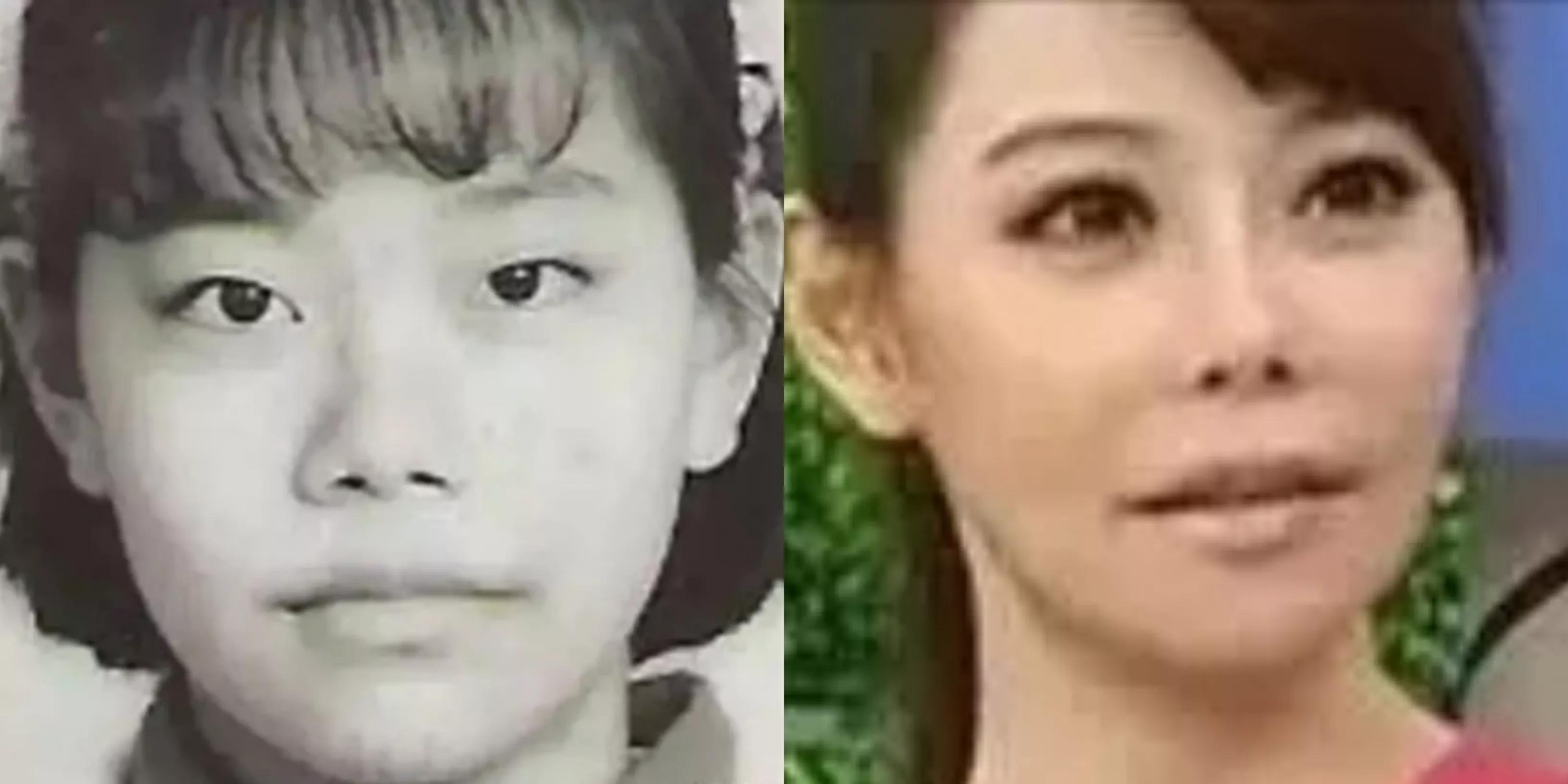 盘点那些整容整的最厉害的人,整容整的最厉害的三位女士