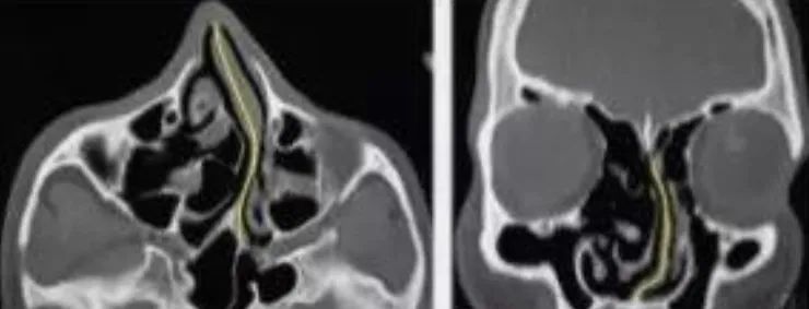 在*裤内**里加燕窝和胶原这种鬼话都说得出来？