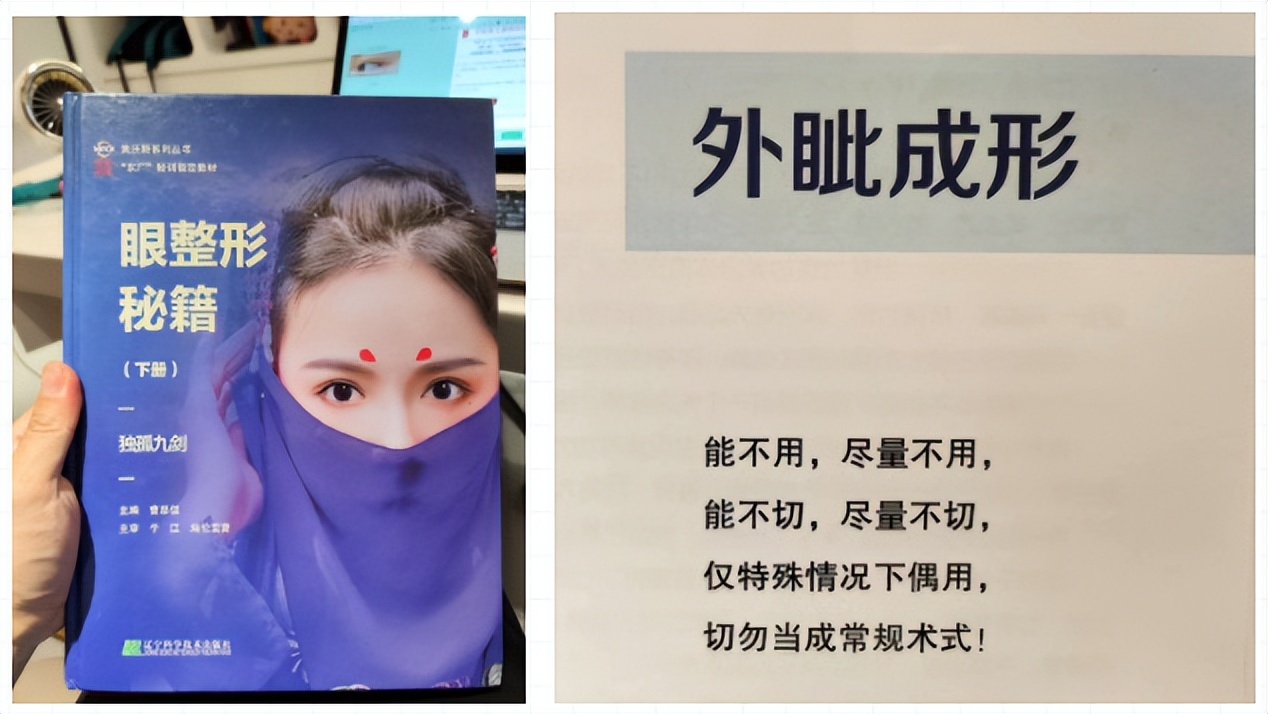 开外眼角优点和缺点,外眼角开的不明显还可以再开吗