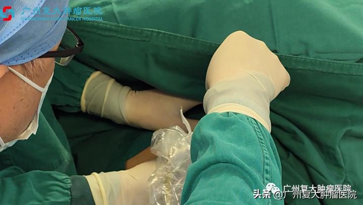 肝肿瘤靠近心脏，微波如何消融？