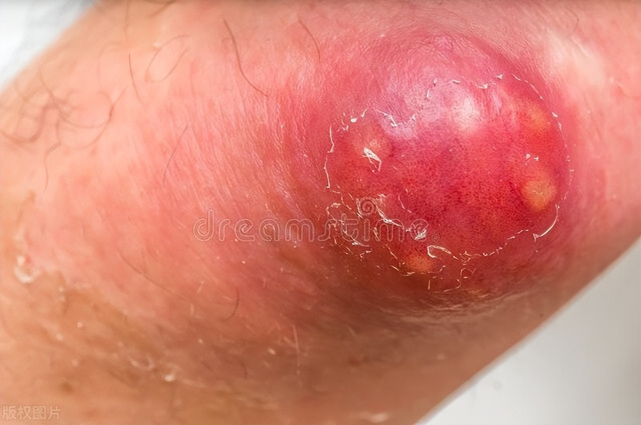 妈妈60岁了手上有好多斑点是什么,妈妈66岁额头上长了很多横纹